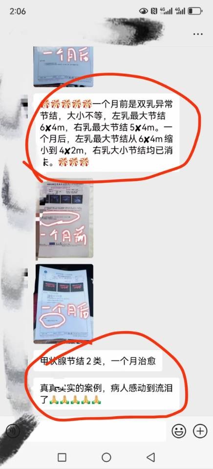 高氏消结节外敷配方