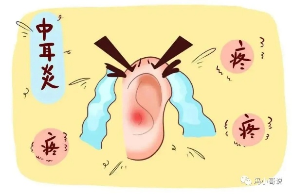 中耳炎配方
