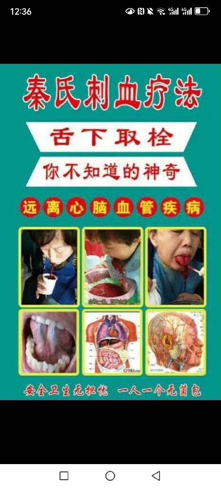 【中风偏摊后遗症康复专科治疗技术】