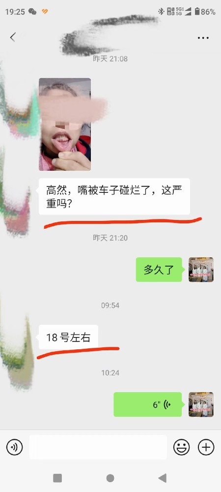 高氏口腔溃疡药粉  配方99元  纯中药，本人给亲朋好友十几个人用过，效果不错，药粉用棉签涂压在溃疡面十几分钟，然后再吐掉，一天三五次都可。 配方都是常见药，一副药几十块钱  一次见效，验方